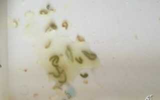 Черные прожилки в отделяемом из носа