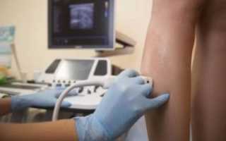 УЗИ артерий нижних конечностей