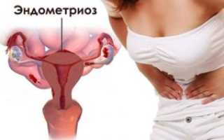 Месячные во время лечения Диферелином