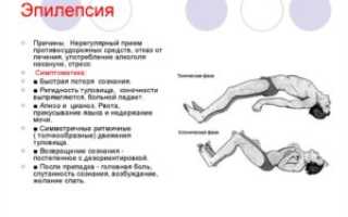 Эпилепсия во время месячных