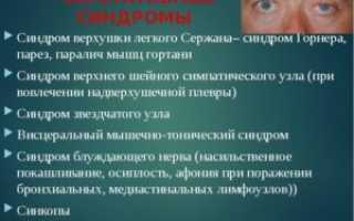 Чем лечить задний шейный симпатический синдром