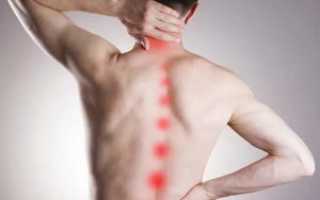 Мышечный невроз