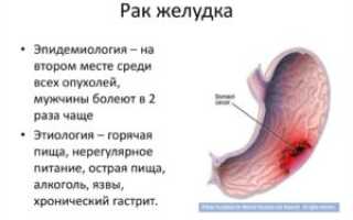 Может ли быстро развиться рак желудка?