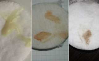 Выделения перед месячными за 4 дня до месячных