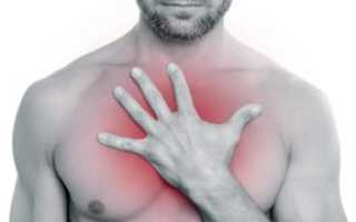 Давит в области груди.