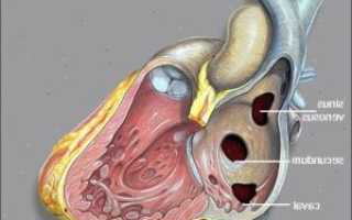 Мембрана в сердце