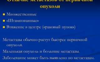 Метастазы или первичный рак?