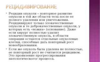 Возможен ли рецидив доброкачественной опухоли