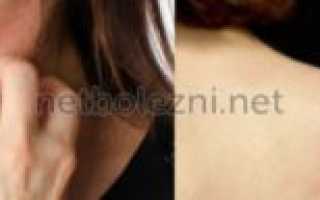 Моему отцу 80 лет, как облегчить состояние зуда кожи?