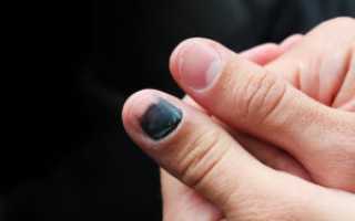 Черный ноготь. После удара