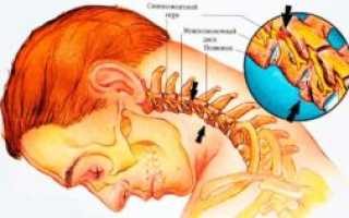 Что происходит с моей головой и желание вертеть шеей?