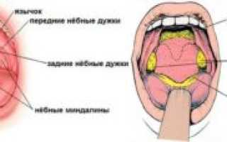 На небной дужке маленький прощупываемый шарик