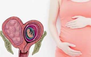 Миома при беременности
