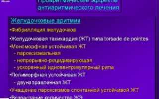 Мерцательная аритмия и антиаритмики
