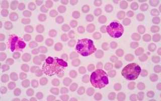 Эозинофилы 14