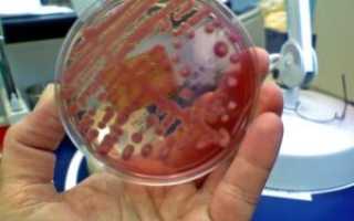 Дискомфорт в уретре. Клебсиелла пневмония