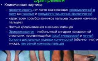 Эритремия и C92.7это диагноз одной болезни?