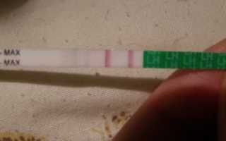 Выделения на 15-17 дц