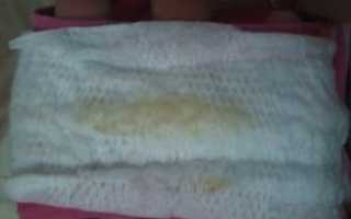 Выделения при длительном приеме КОК