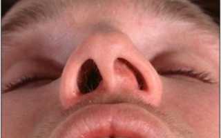 В носу что то мешает