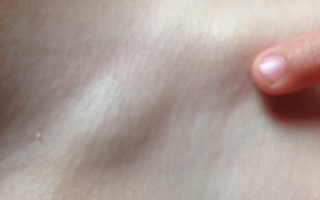 Внутренние шишечки и прыщи в паховой зоне