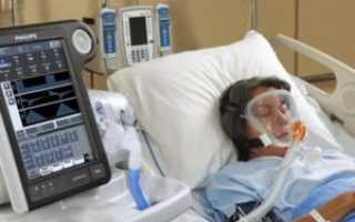 Двухсторонняя пневмония, высокая температура, подключен к ИВЛ