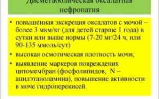Дисметаболическая нефропатия