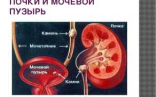 Мочевой пузырь и боли в почке