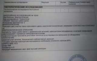 Что означают результаты биопсии и посоветуйте схему(лекарства) лечения