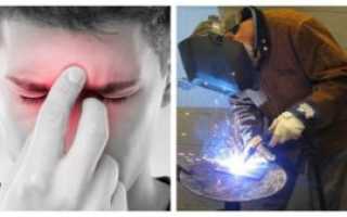 Нахватался зайчиков от сварки