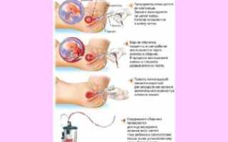 Можно ли делать аборт при температуре?