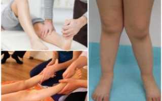 Варус или вальгус?