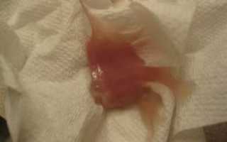 Выделения после фармаборта