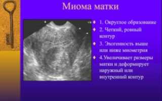 Миома матки малых размеров
