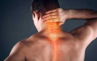 Напряженность мышц шеи