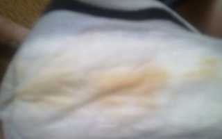 Выделения на 35 неделе беременности