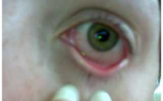 Мутно в глазах после сна