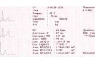 Достаточно ли раз в год делать ЭКГ и анализ крови?