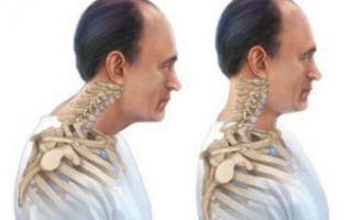 Что происходит с моей головой и желание вертеть шеей?