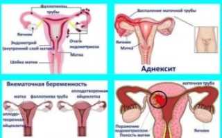 Могут ли гормоны вызвать боли в низу живота
