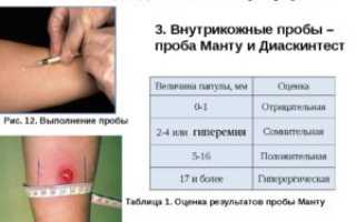 Можно ли делать пробу манту при реактивном панкреатите