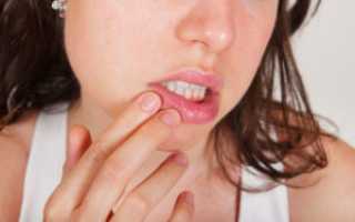 Чешется небо до ранок во рту