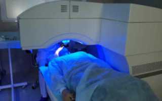 Преимущества метода Фемто-ЛАЗИК