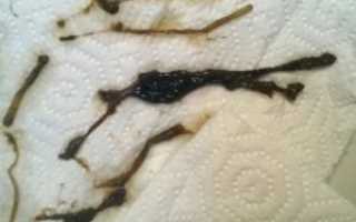 Месячные у девочек 12 лет черного цвета