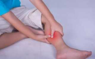 Дергается нога