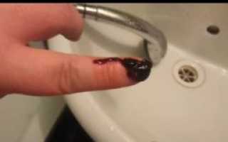 Месячные после МА