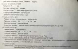 На осмотре сказали что беременность есть, узи не подтвердило