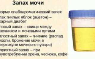 Моча пахнет лапшой быстрого приготовления