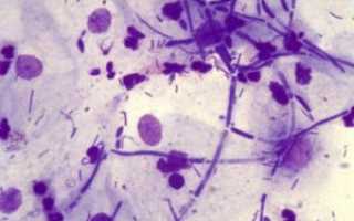 Микроскопическое (бактериоскопическое) исследование мазка, окрашенного по Граму (Gram Stain. Bacteri