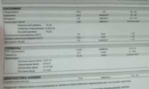 Высокий прогестерон на 21 день цикла